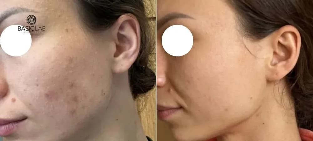 Serum z witaminą C co daje? Odkryj niesamowite efekty dla skóry